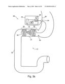 DUODENAL STIMULATION DEVICES AND METHODS FOR THE TREATMENT OF CONDITIONS RELATING TO EATING DISORDERS diagram and image