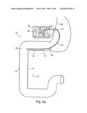 DUODENAL STIMULATION DEVICES AND METHODS FOR THE TREATMENT OF CONDITIONS RELATING TO EATING DISORDERS diagram and image