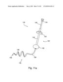 DUODENAL STIMULATION DEVICES AND METHODS FOR THE TREATMENT OF CONDITIONS RELATING TO EATING DISORDERS diagram and image