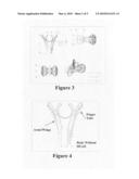 Snap-Off Diet Aid.TM. tragus clip with single-point removable pressure head diagram and image