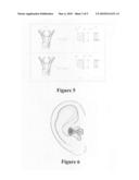 Snap-Off Diet Aid.TM. tragus clip with single-point removable pressure head diagram and image