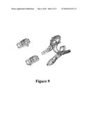 Snap-Off Diet Aid.TM. tragus clip with single-point removable pressure head diagram and image