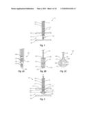 CLOSURE DEVICE diagram and image