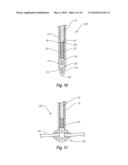 CLOSURE DEVICE diagram and image