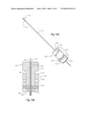 CLOSURE DEVICE diagram and image