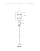 CLOSURE DEVICE diagram and image