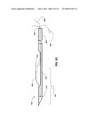 T-TYPE SUTURE ANCHOR diagram and image