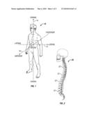 POSTERIOR DYNAMIC STABILIZATION SYSTEM WITH PIVOTING COLLARS diagram and image