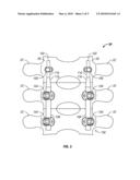 POSTERIOR DYNAMIC STABILIZATION SYSTEM WITH PIVOTING COLLARS diagram and image