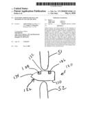 EXTENSION LIMITING DEVICES AND METHODS OF USE FOR THE SPINE diagram and image