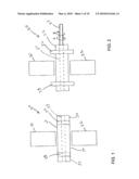 EXTENSION LIMITING DEVICES AND METHODS OF USE FOR THE SPINE diagram and image