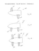 EXTENSION LIMITING DEVICES AND METHODS OF USE FOR THE SPINE diagram and image