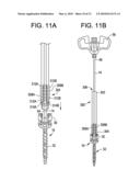 Systems and Methods for Delivering Bone Cement to a Bone Anchor diagram and image