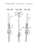 Systems and Methods for Delivering Bone Cement to a Bone Anchor diagram and image