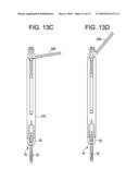 Systems and Methods for Delivering Bone Cement to a Bone Anchor diagram and image