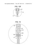 Systems and Methods for Delivering Bone Cement to a Bone Anchor diagram and image