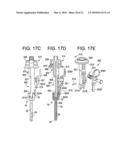 Systems and Methods for Delivering Bone Cement to a Bone Anchor diagram and image