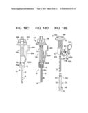 Systems and Methods for Delivering Bone Cement to a Bone Anchor diagram and image