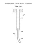 Systems and Methods for Delivering Bone Cement to a Bone Anchor diagram and image