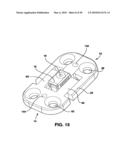 Static Compression Device diagram and image