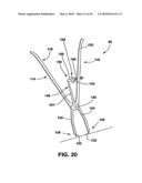 Static Compression Device diagram and image