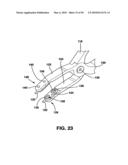 Static Compression Device diagram and image