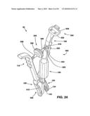 Static Compression Device diagram and image