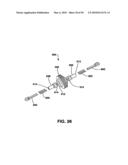 Static Compression Device diagram and image