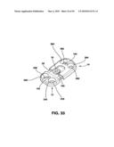 Static Compression Device diagram and image