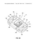 Static Compression Device diagram and image