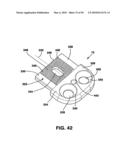 Static Compression Device diagram and image