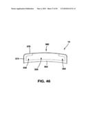 Static Compression Device diagram and image