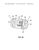 Static Compression Device diagram and image