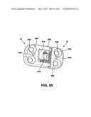 Static Compression Device diagram and image