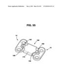 Static Compression Device diagram and image