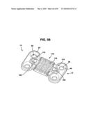 Static Compression Device diagram and image