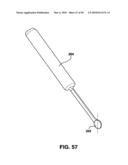 Static Compression Device diagram and image