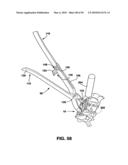 Static Compression Device diagram and image