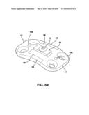 Static Compression Device diagram and image