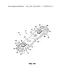 Static Compression Device diagram and image