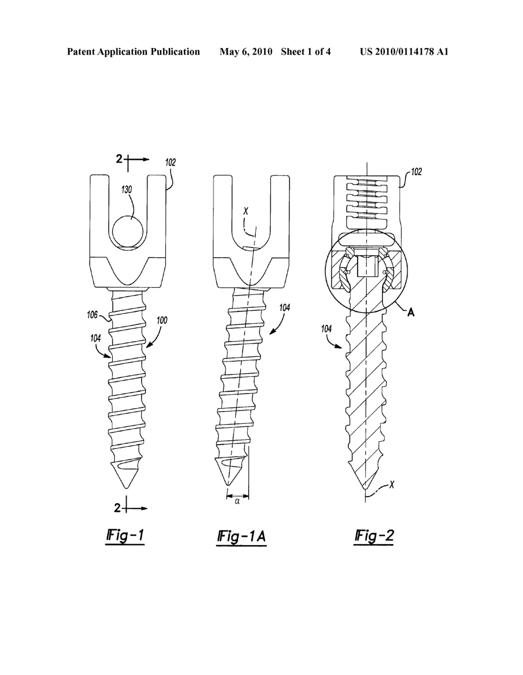 BONE FIXATION ASSEMBLY - diagram, schematic, and image 02