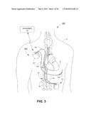 THERAPY MODULE CROSSTALK MITIGATION diagram and image