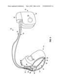 IMPLANTABLE MEDICAL DEVICE CROSSTALK EVALUATION AND MITIGATION diagram and image