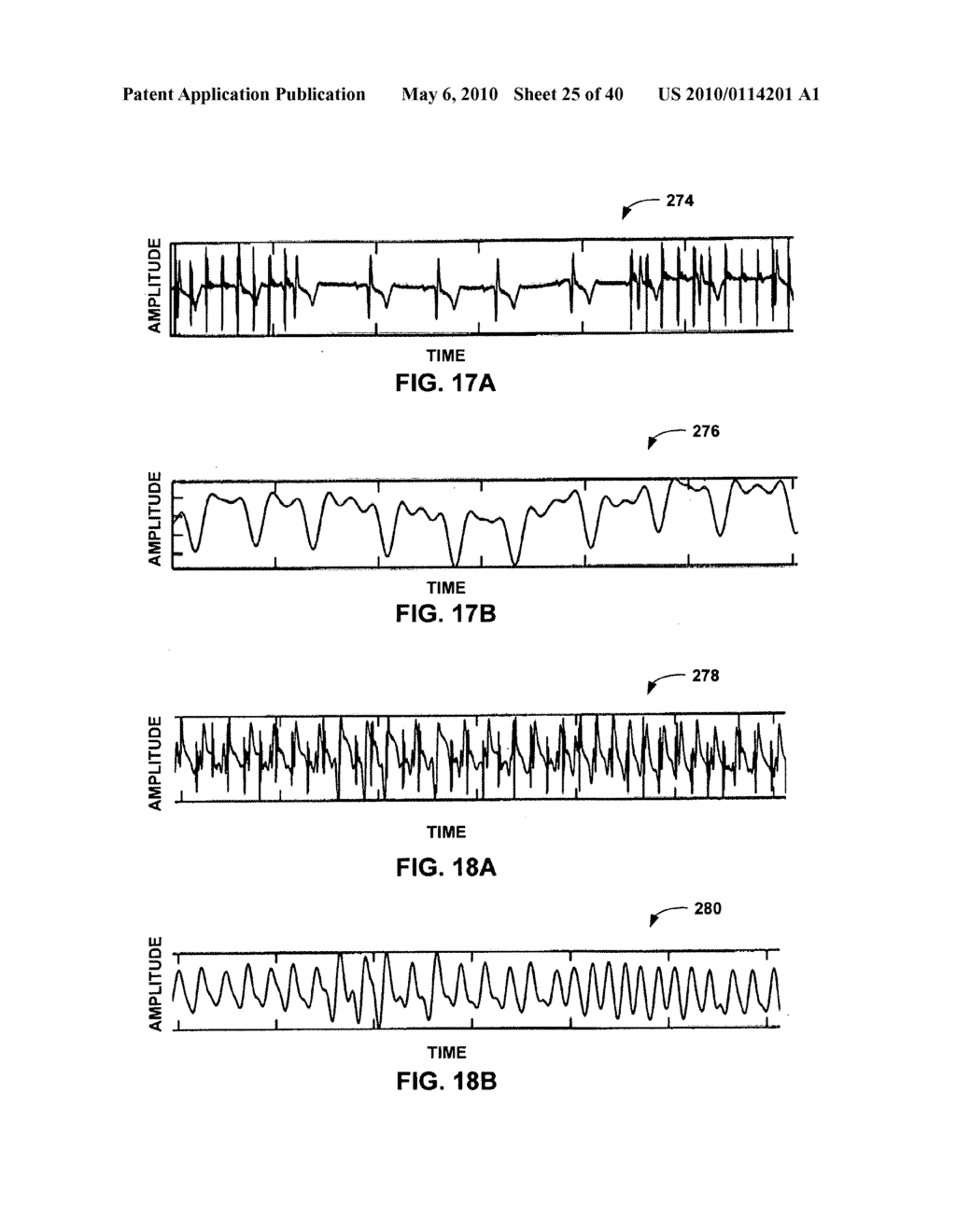 IMPLANTABLE MEDICAL DEVICE CROSSTALK EVALUATION AND MITIGATION - diagram, schematic, and image 26