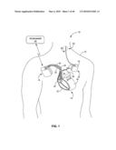 IMPLANTABLE MEDICAL DEVICE CROSSTALK EVALUATION AND MITIGATION diagram and image