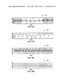 IMPLANTABLE MEDICAL DEVICE CROSSTALK EVALUATION AND MITIGATION diagram and image