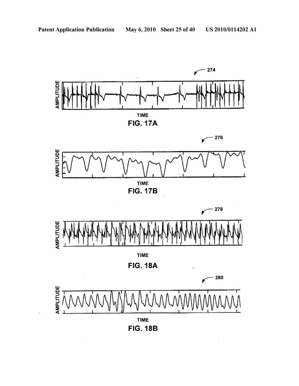 IMPLANTABLE MEDICAL DEVICE CROSSTALK EVALUATION AND MITIGATION - diagram, schematic, and image 26