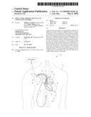 IMPLANTABLE MEDICAL DEVICE LEAD CONNECTION ASSEMBLY diagram and image