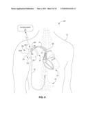 IMPLANTABLE MEDICAL DEVICE LEAD CONNECTION ASSEMBLY diagram and image