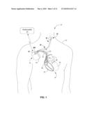 THERAPY SYSTEM INCLUDING CARDIAC RHYTHM THERAPY AND NEUROSTIMULATION CAPABILITIES diagram and image